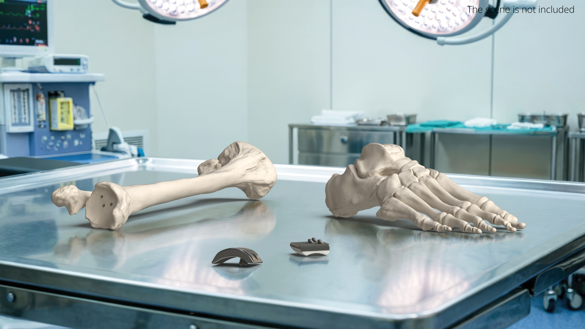Ankle Joint Implant with Tibia Fibula and Foot Bones, view 2