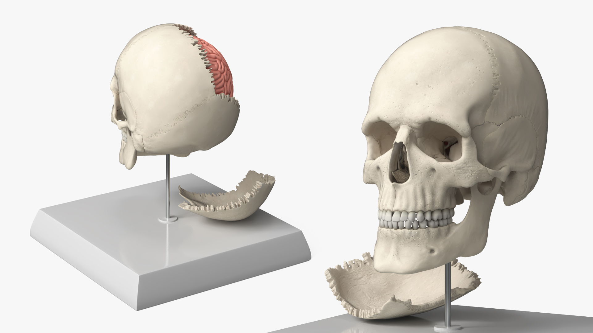 Disassemblable Demonstration Skull with Brain - view 5