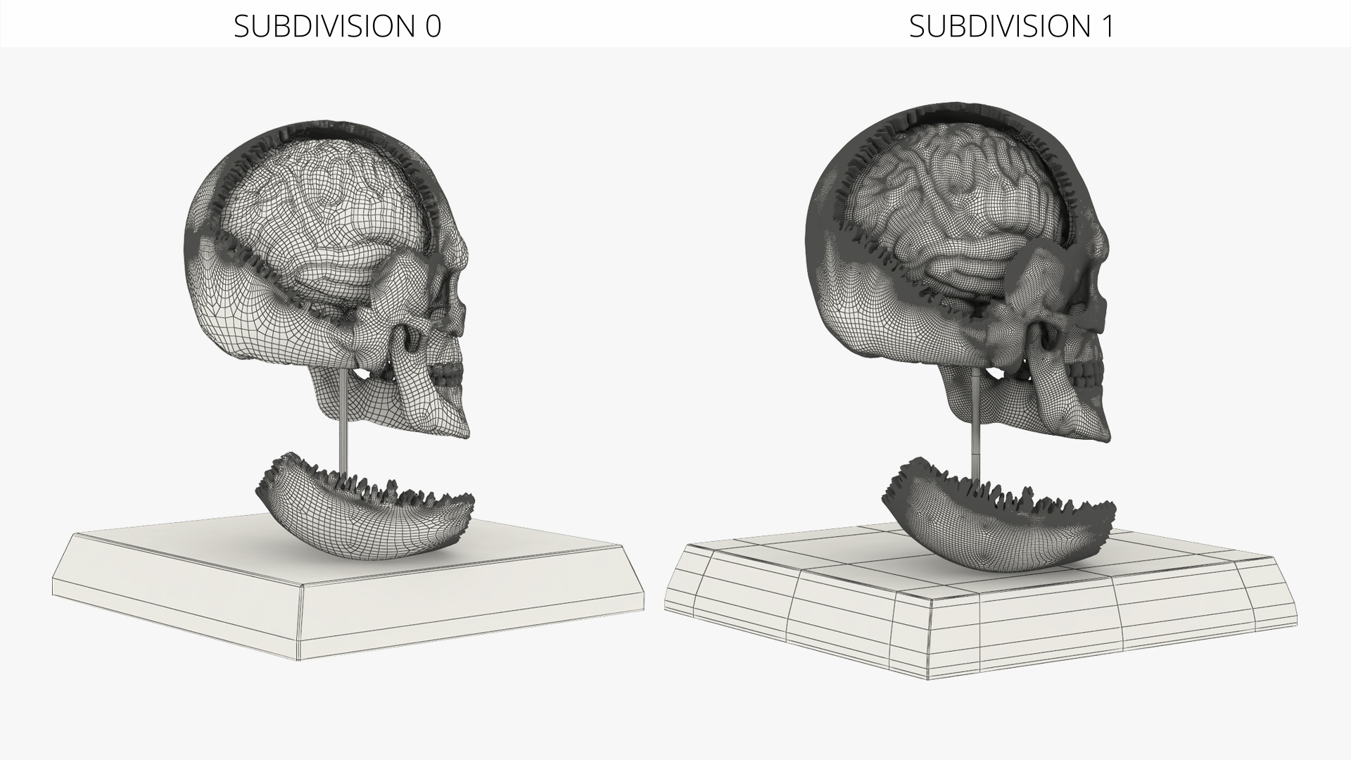 Disassemblable Demonstration Skull with Brain - view 9