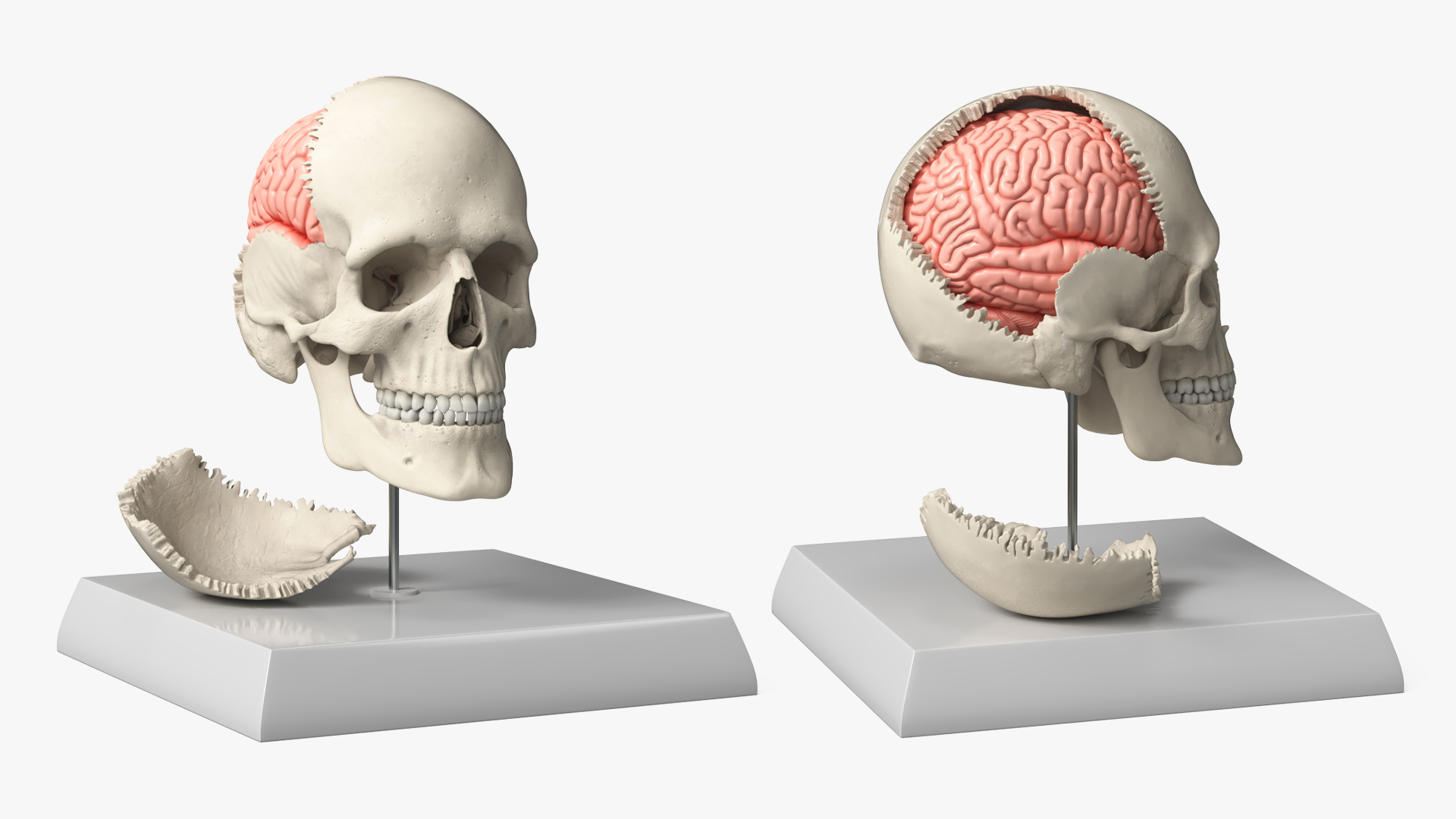 Disassemblable Demonstration Skull with Brain - view 4
