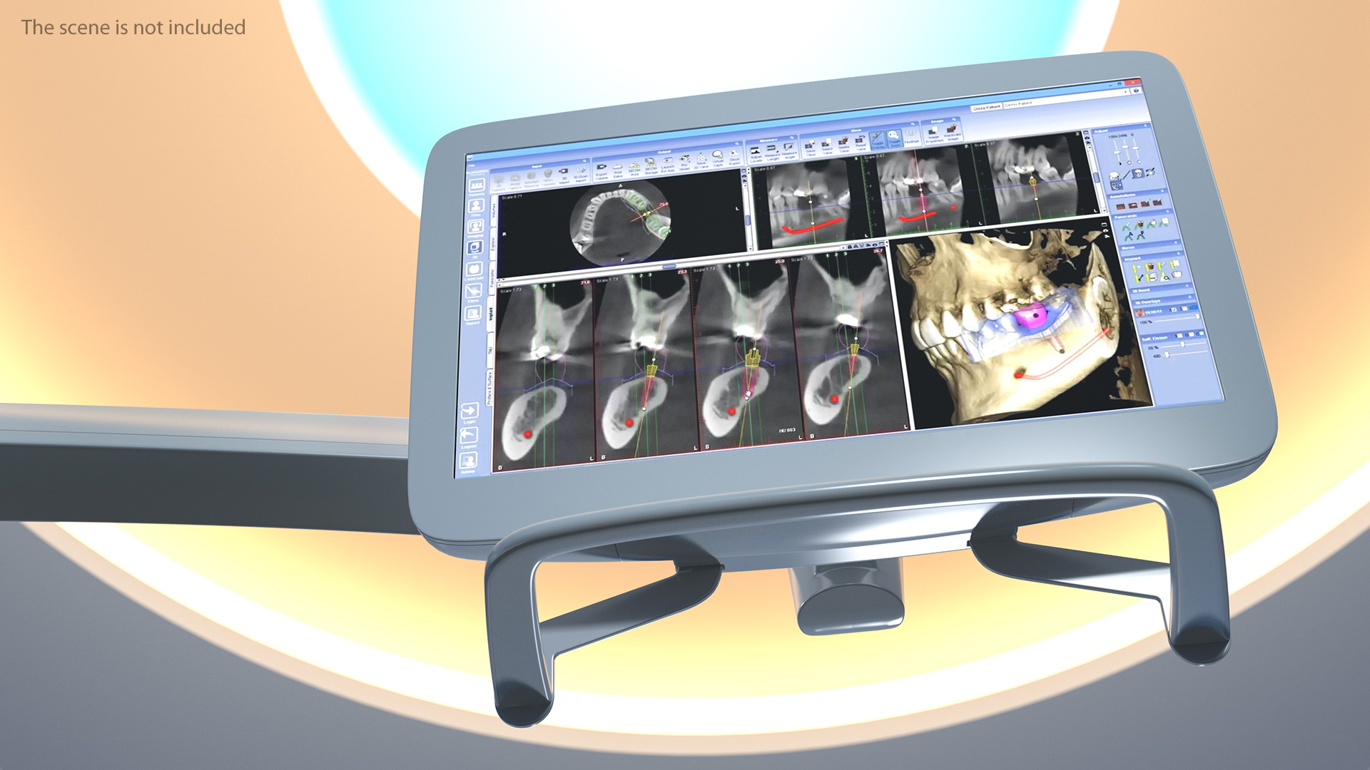 3D Post Mounted Dental LCD Display
