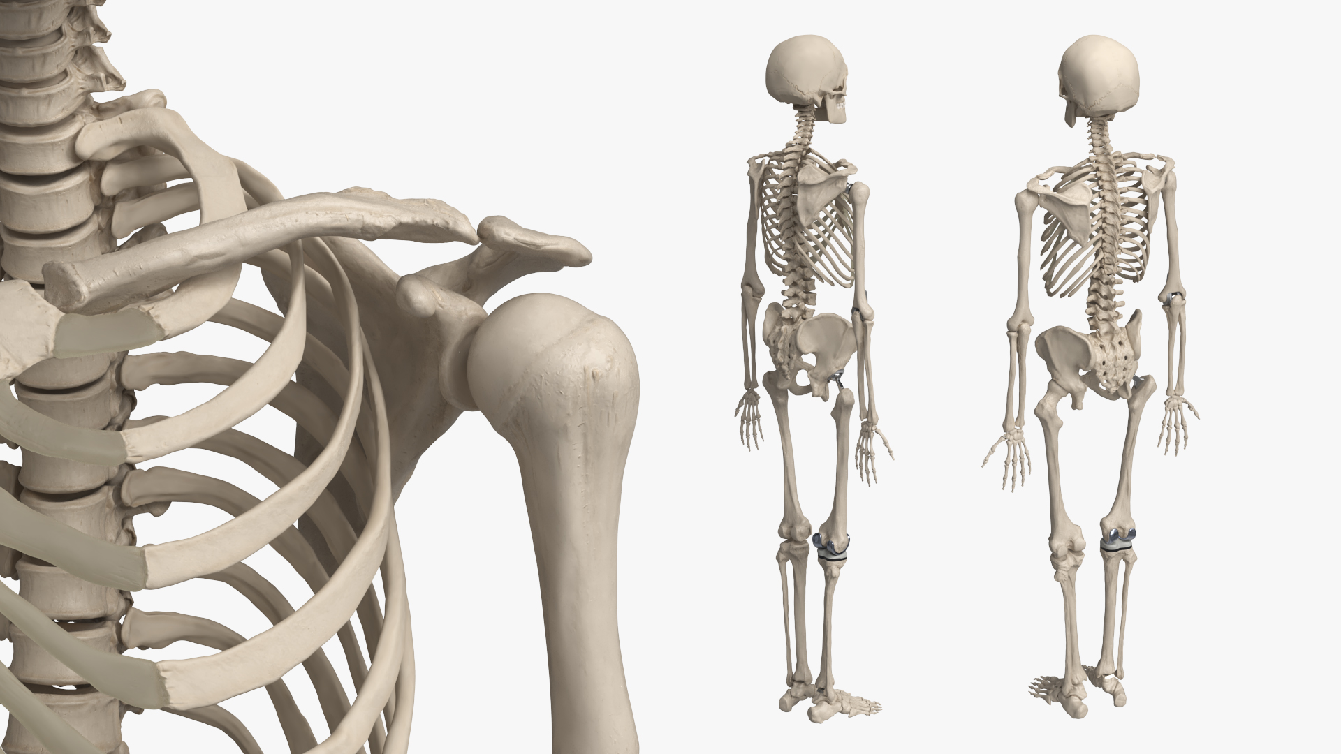 Male Skeleton with Joint Implants Ivory, view 4