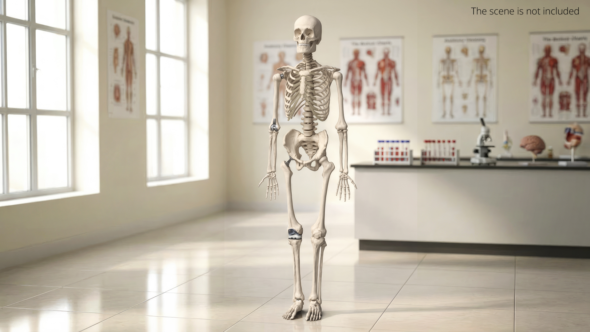 Male Skeleton with Joint Implants Ivory, view 2