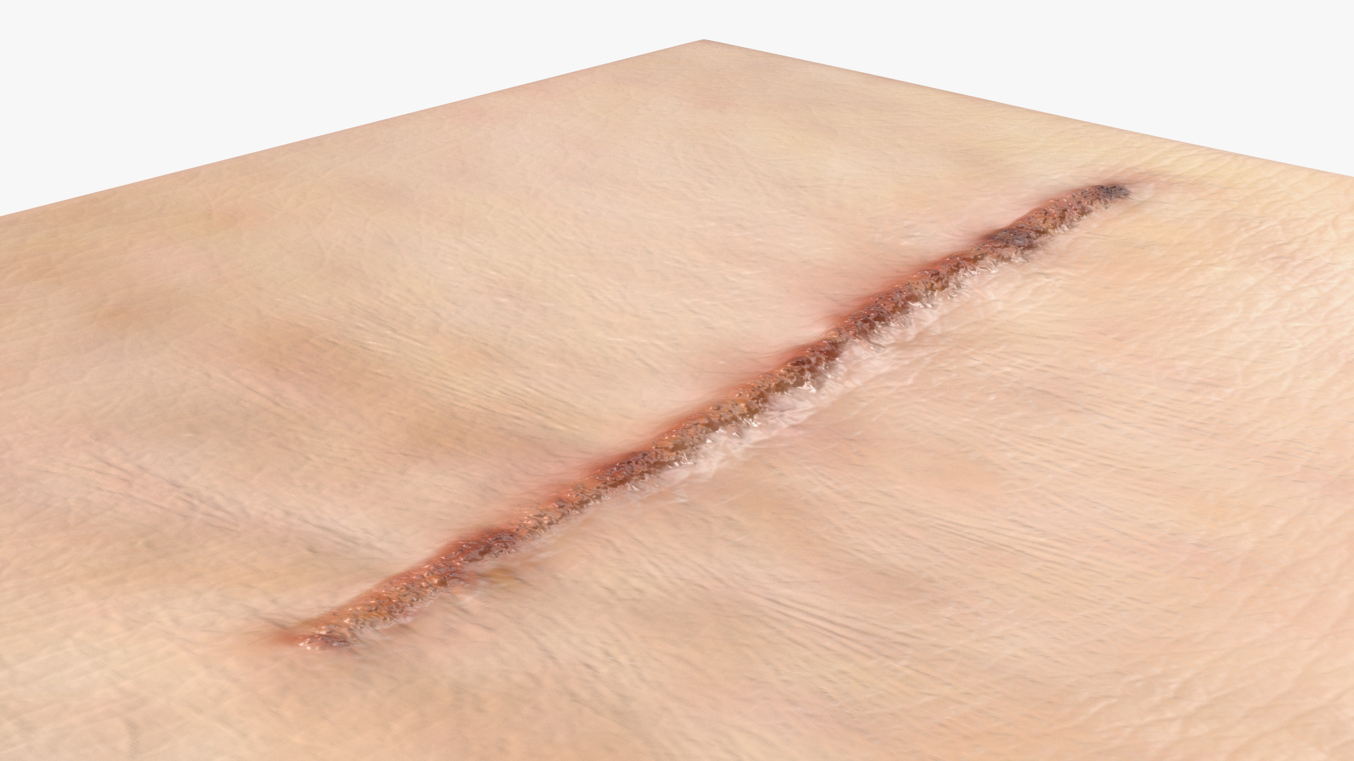 Medical Suture Closed on Skin 3D model