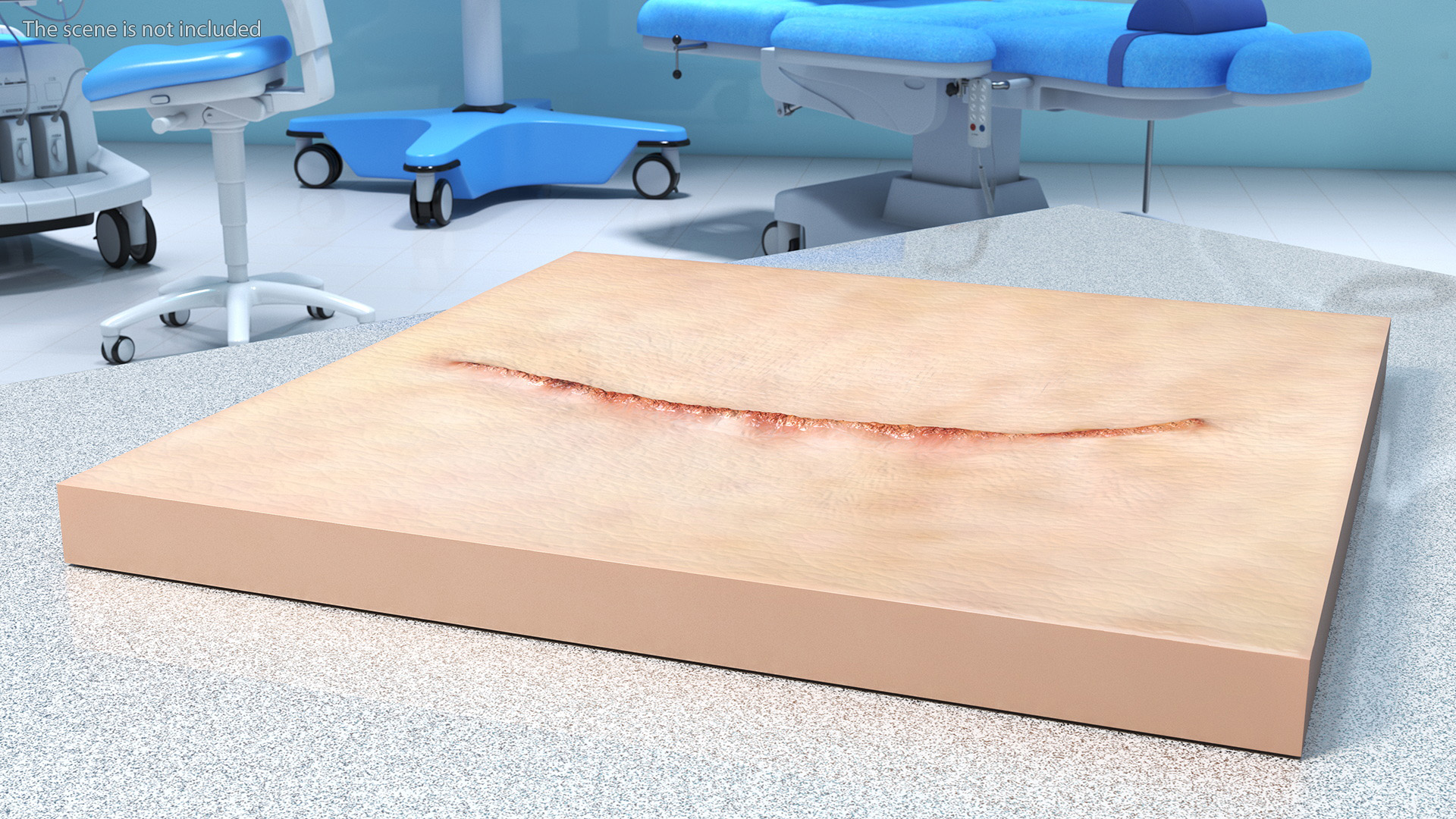 Medical Suture Closed on Skin 3D model