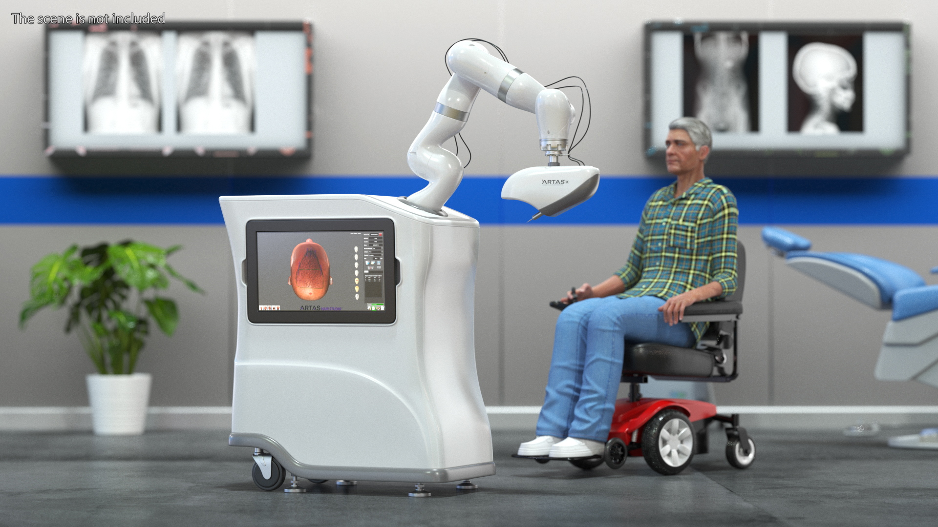 3D ARTAS Robotic Hair Restoration Rigged for Maya