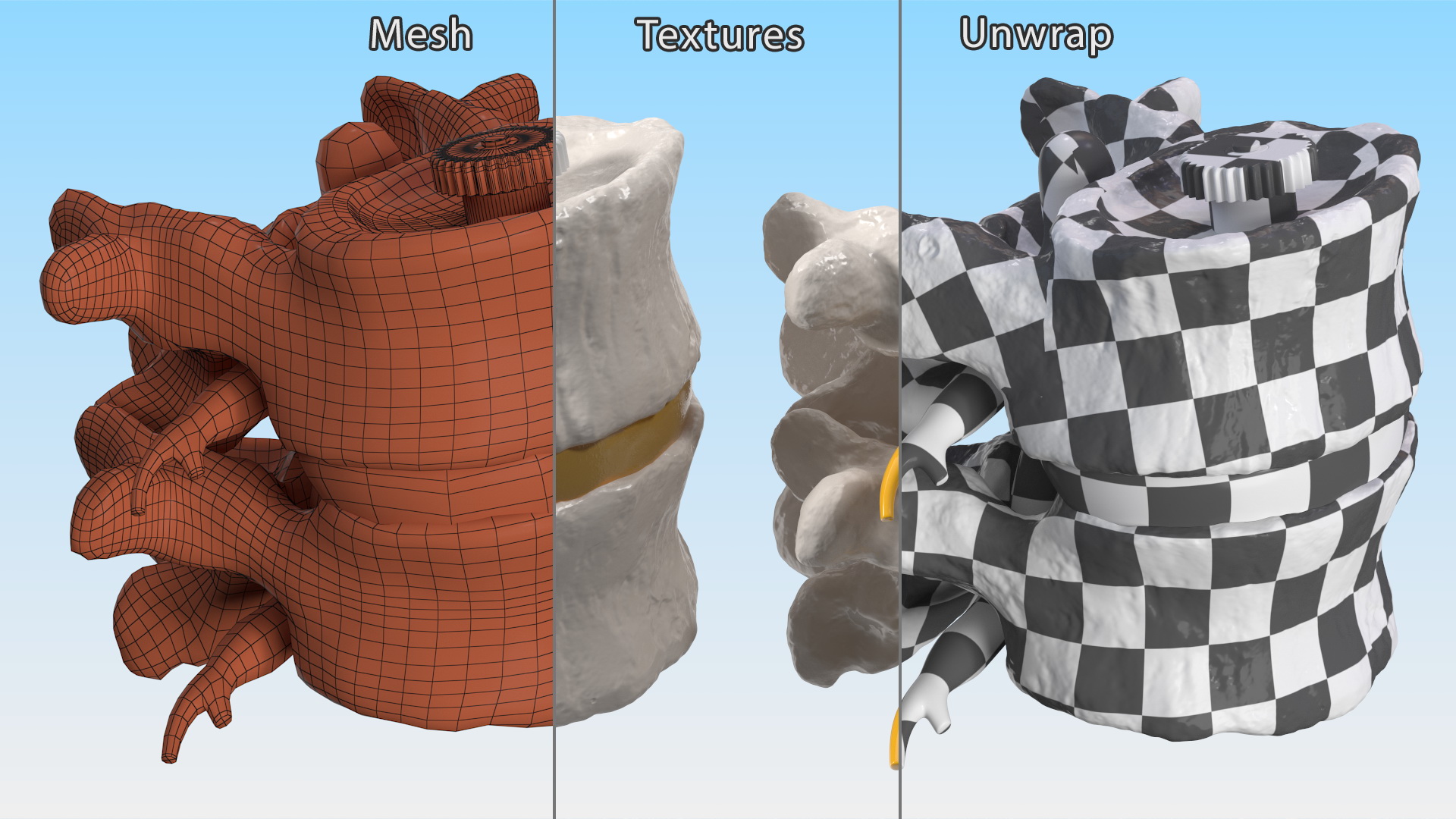 3D Part of Spinal Column with Hernia model