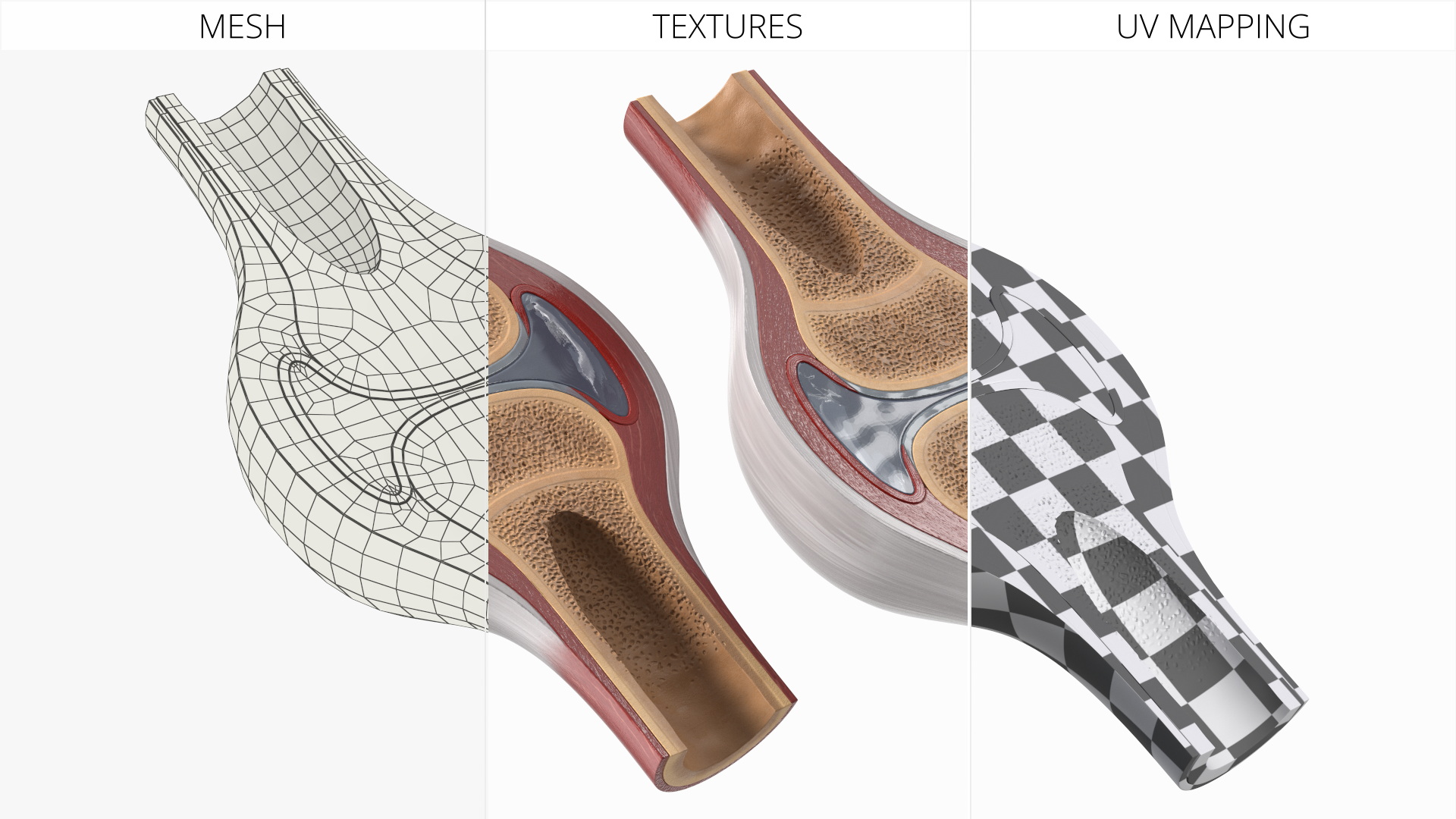 Synovial Joint Cross Section - view 8
