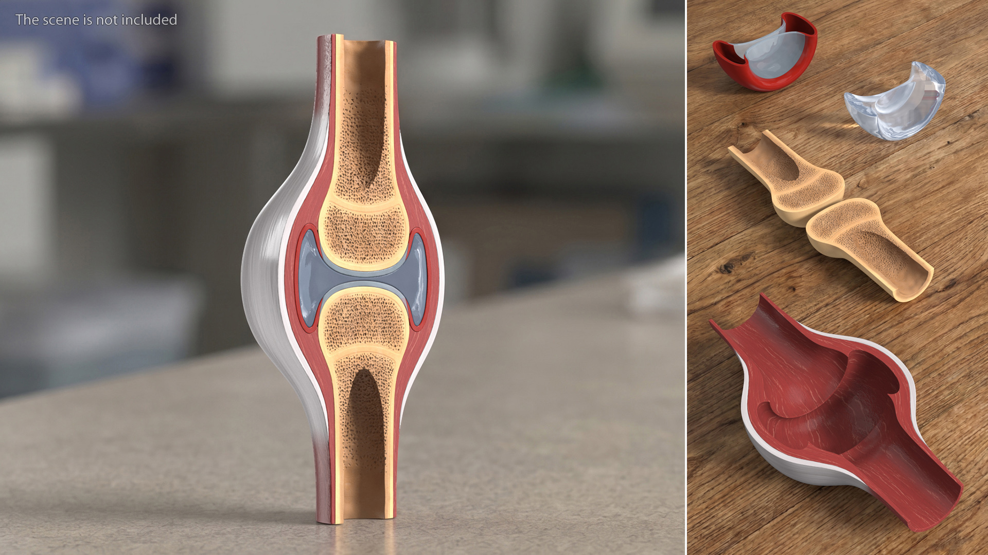 Synovial Joint Cross Section - view 3