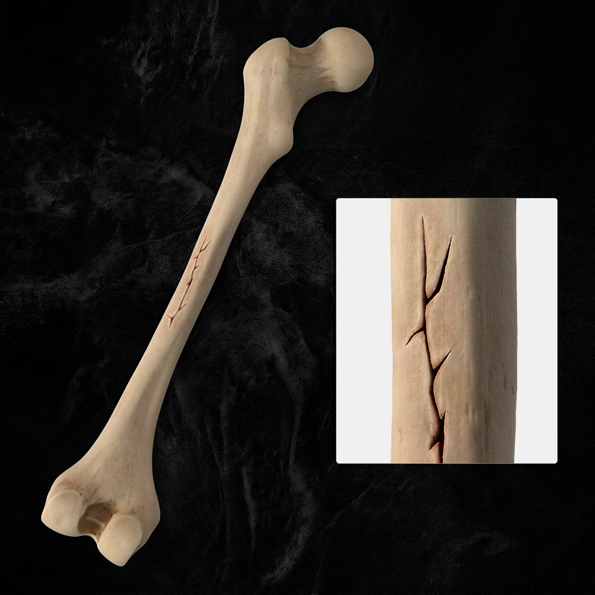 Human Femur Bone Anatomy 3D model preview