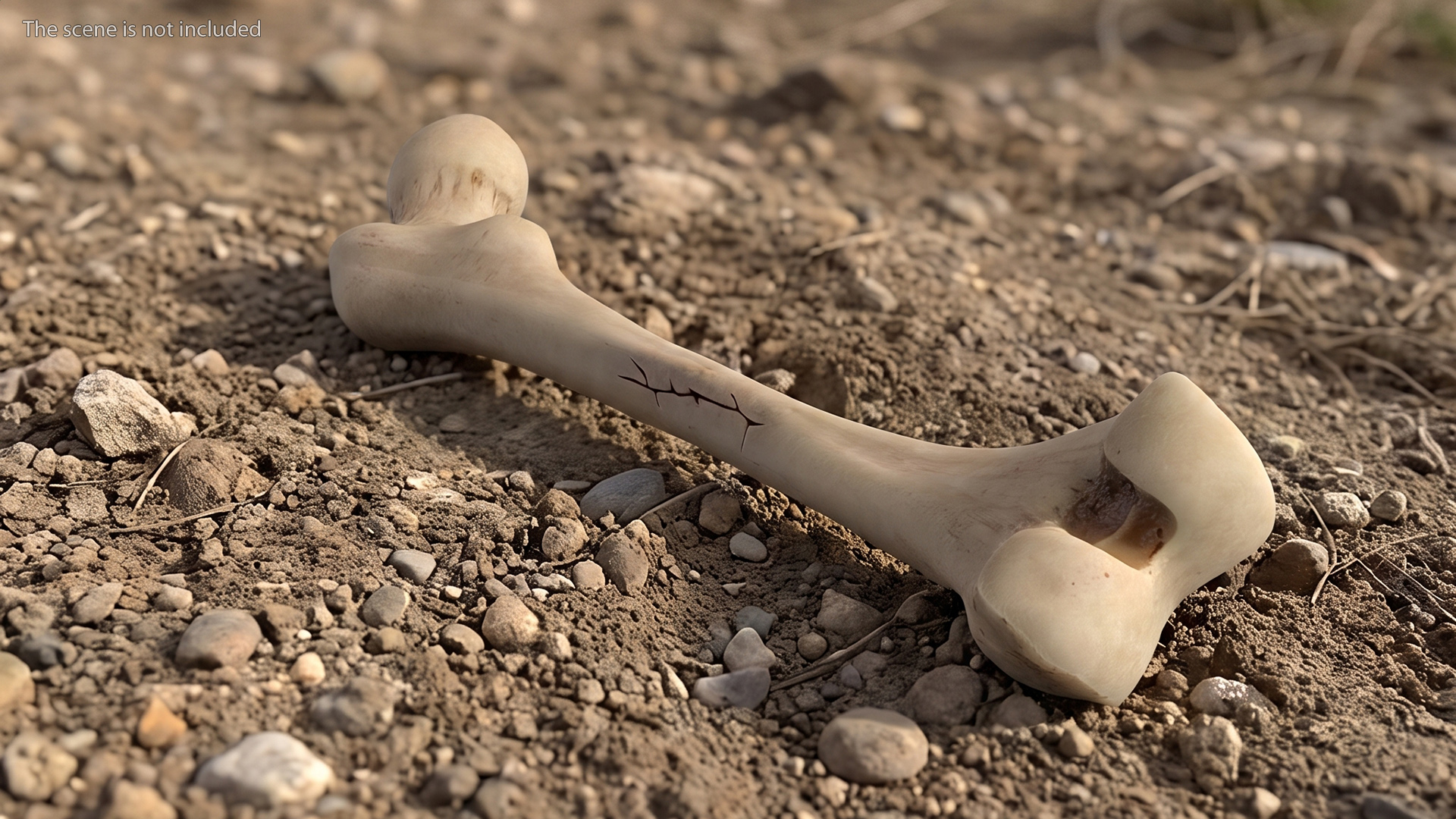 Human Femur Bone Anatomy - view 3