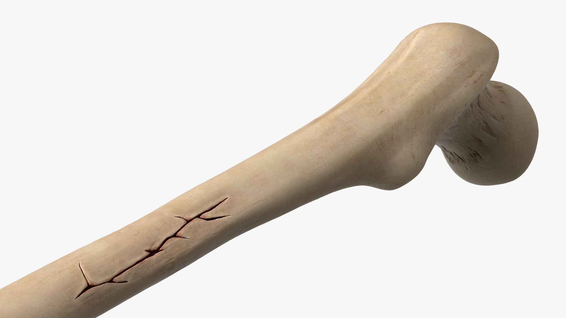 Human Femur Bone Anatomy - view 7