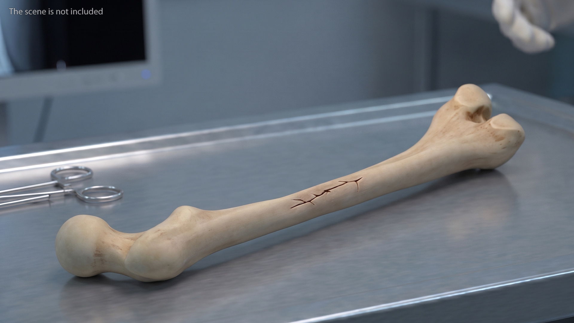 Human Femur Bone Anatomy - view 2