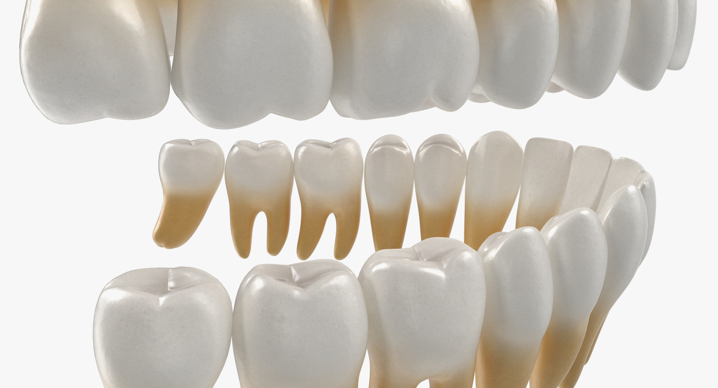 3D Teeth with Braces Model model
