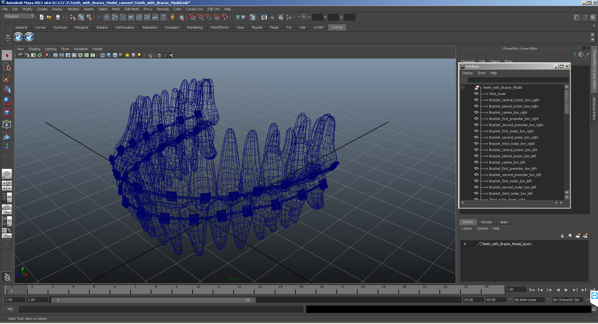3D Teeth with Braces Model model