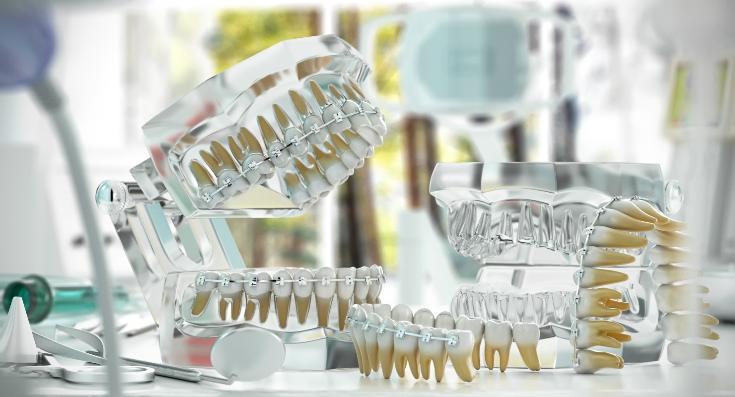 3D Teeth with Braces Model model