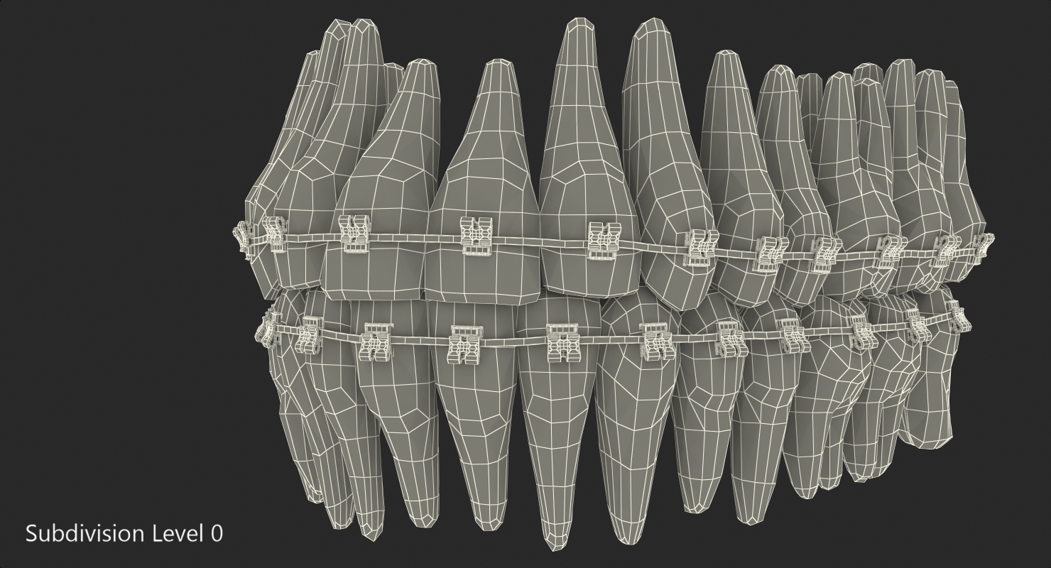 3D Teeth with Braces Model model