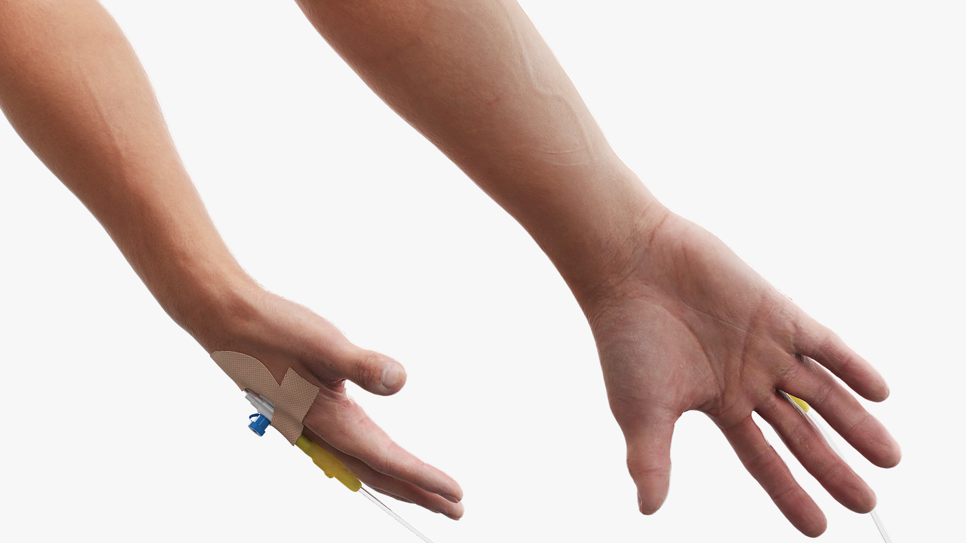 Peripheral IV Cannula with Hand Fixation - view 5