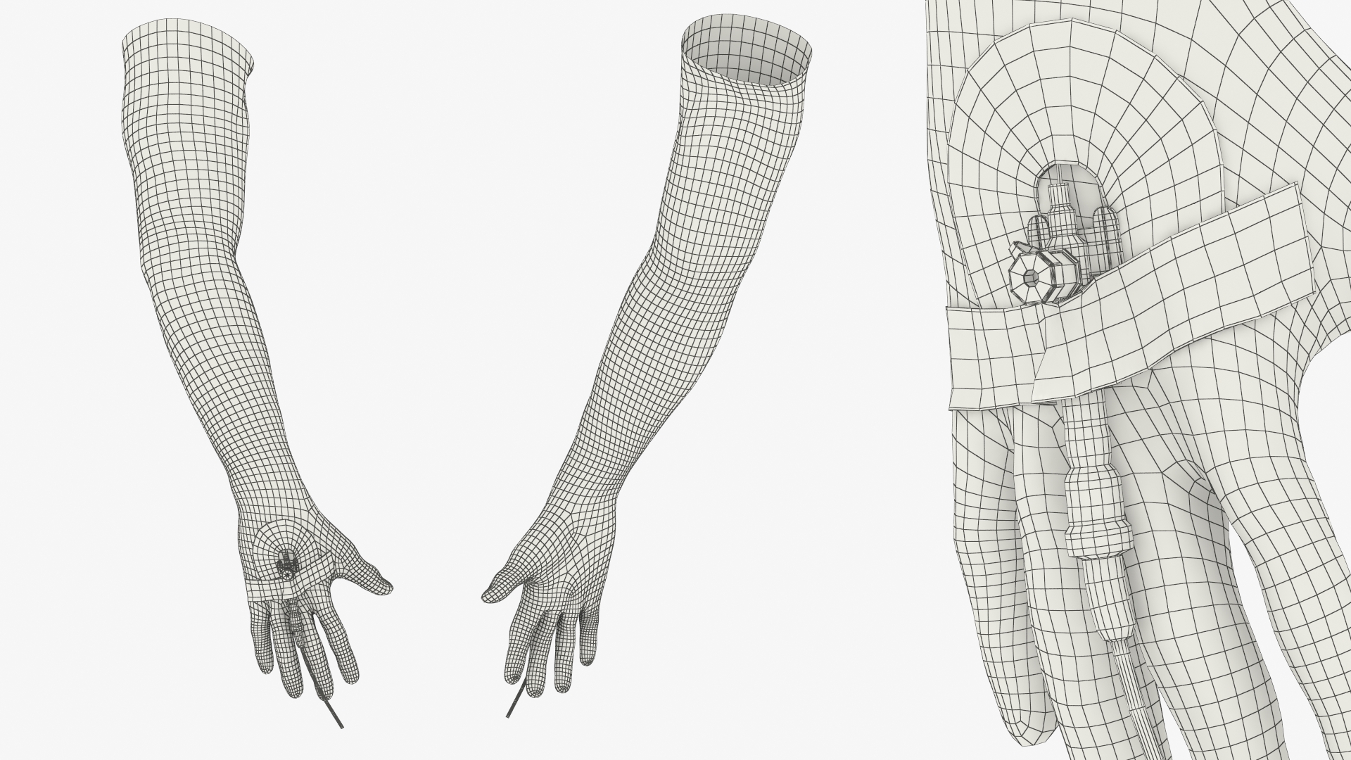 Peripheral IV Cannula with Hand Fixation - view 8