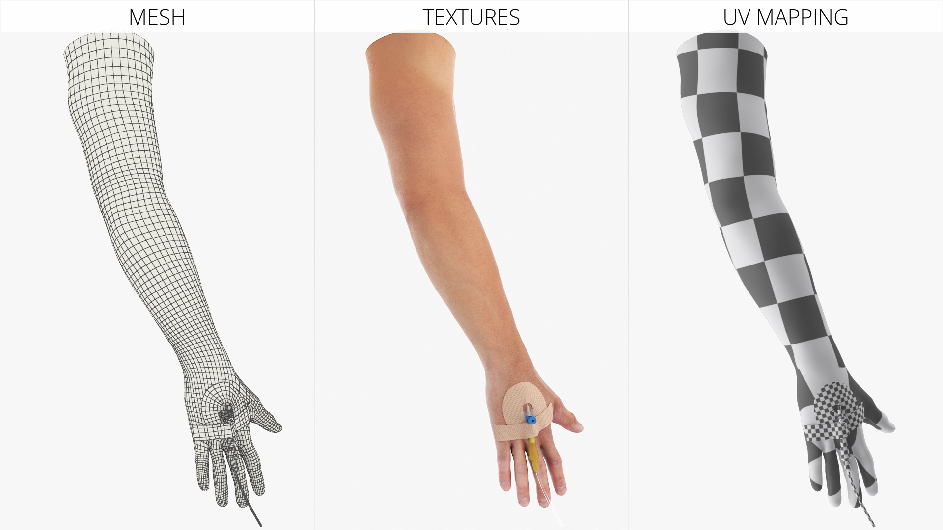Peripheral IV Cannula with Hand Fixation - view 6
