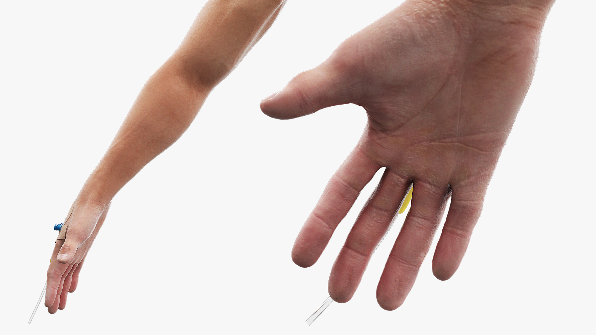 Peripheral IV Cannula with Hand Fixation - view 4