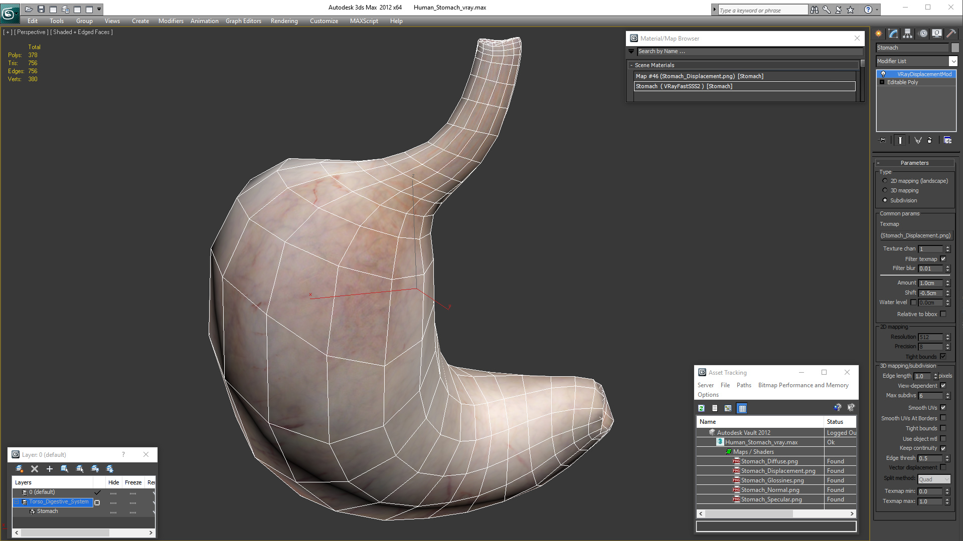 3D Human Stomach model