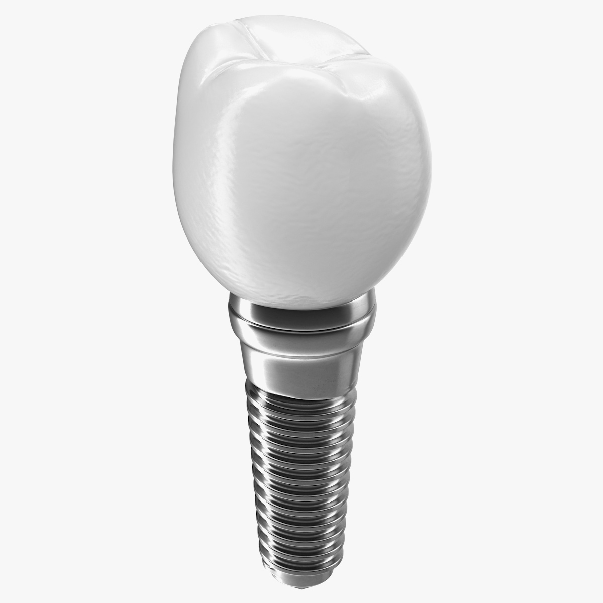 Tooth Dental Implant