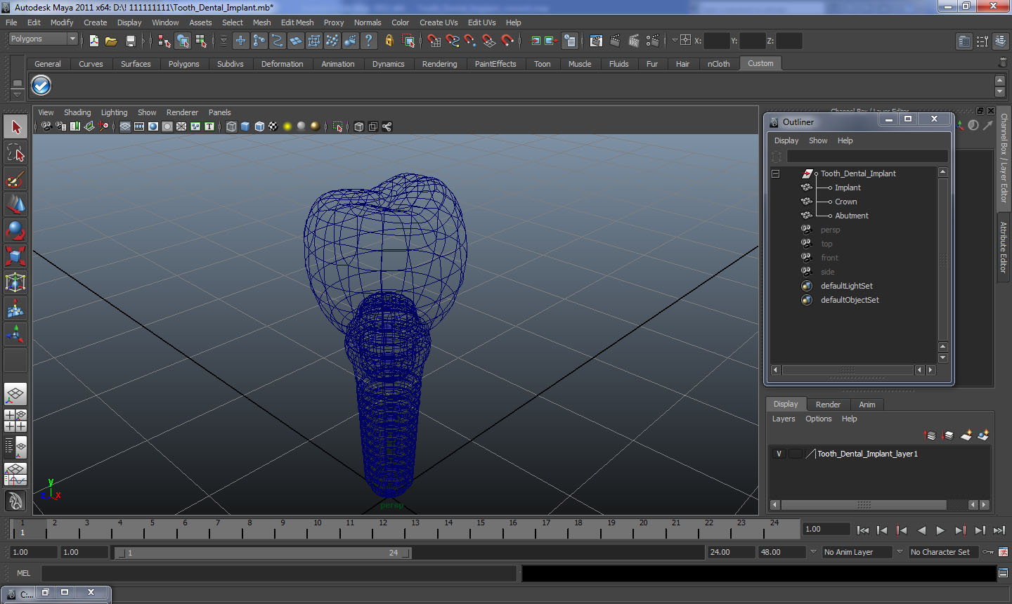 3D model Tooth Dental Implant