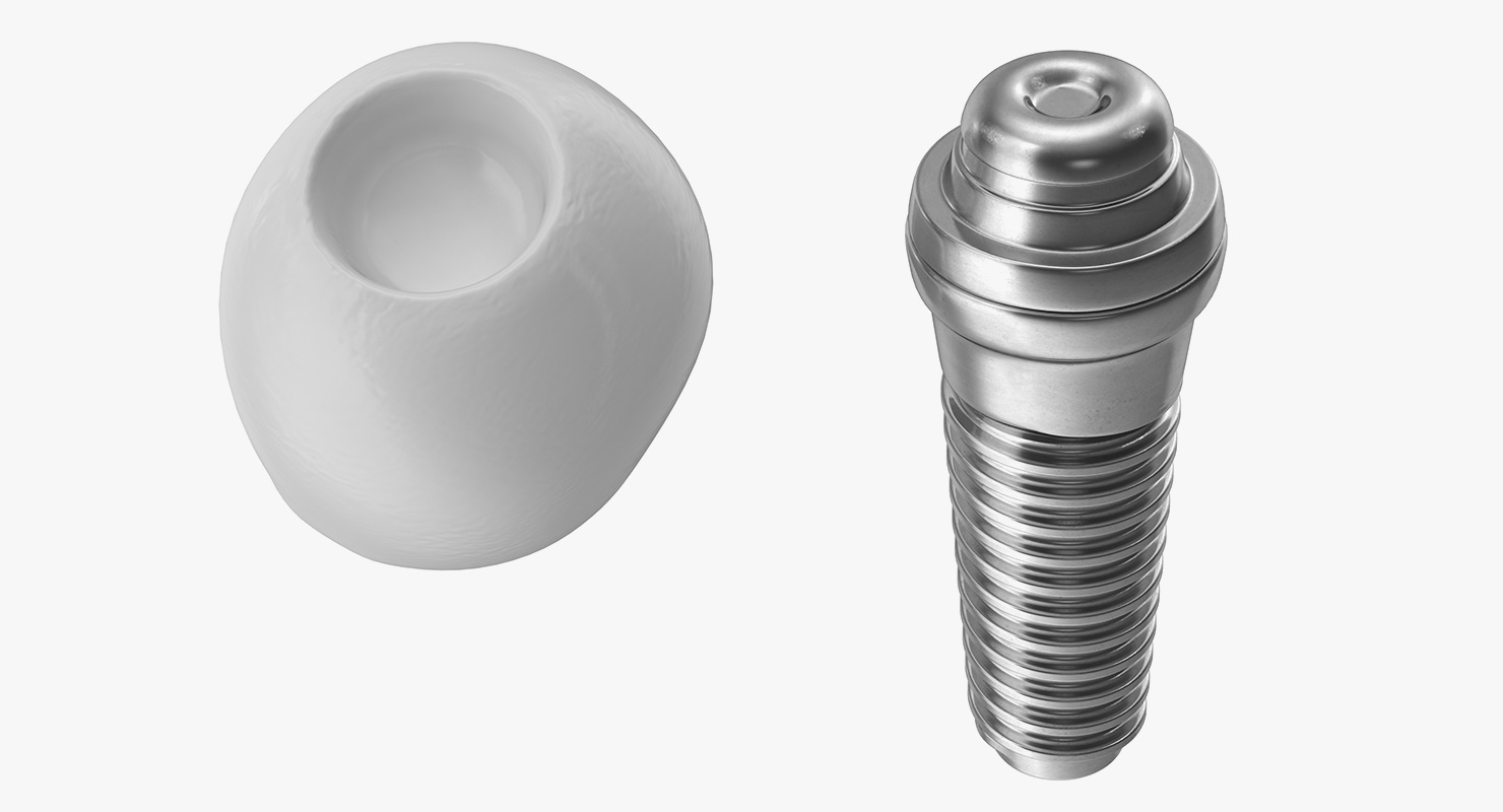 3D model Tooth Dental Implant