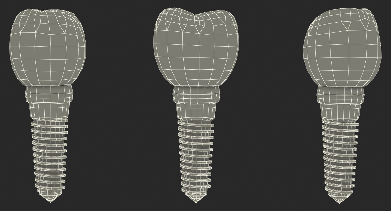 3D model Tooth Dental Implant