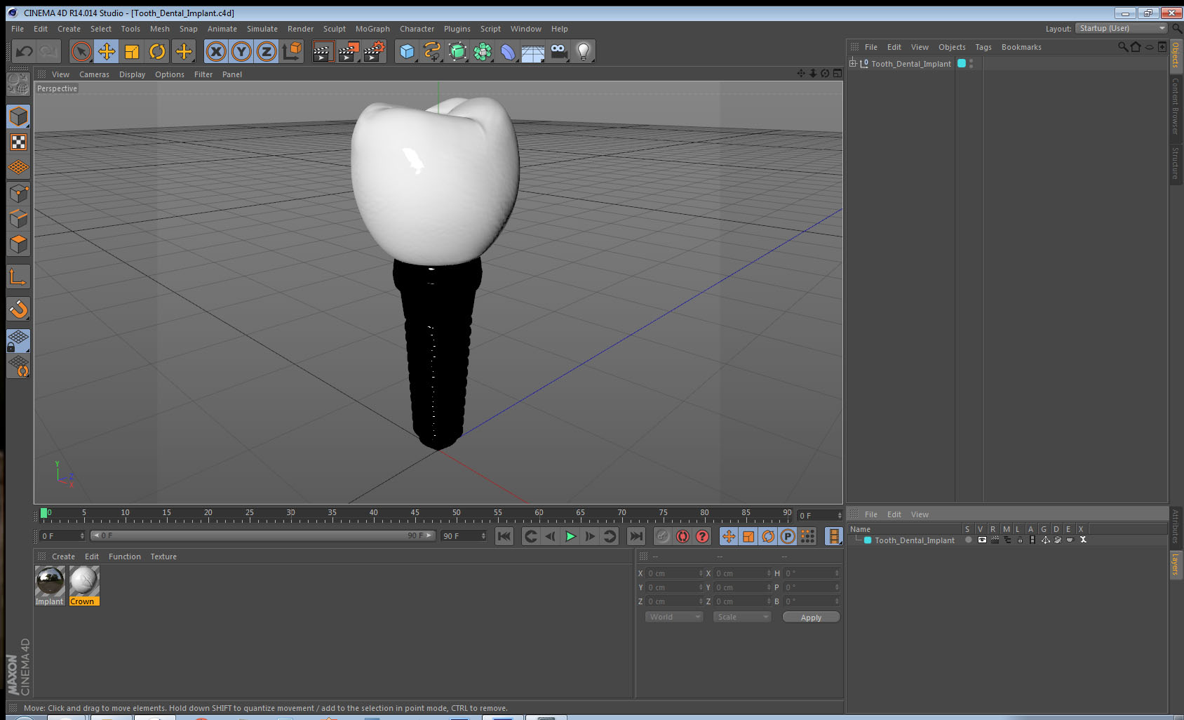 3D model Tooth Dental Implant