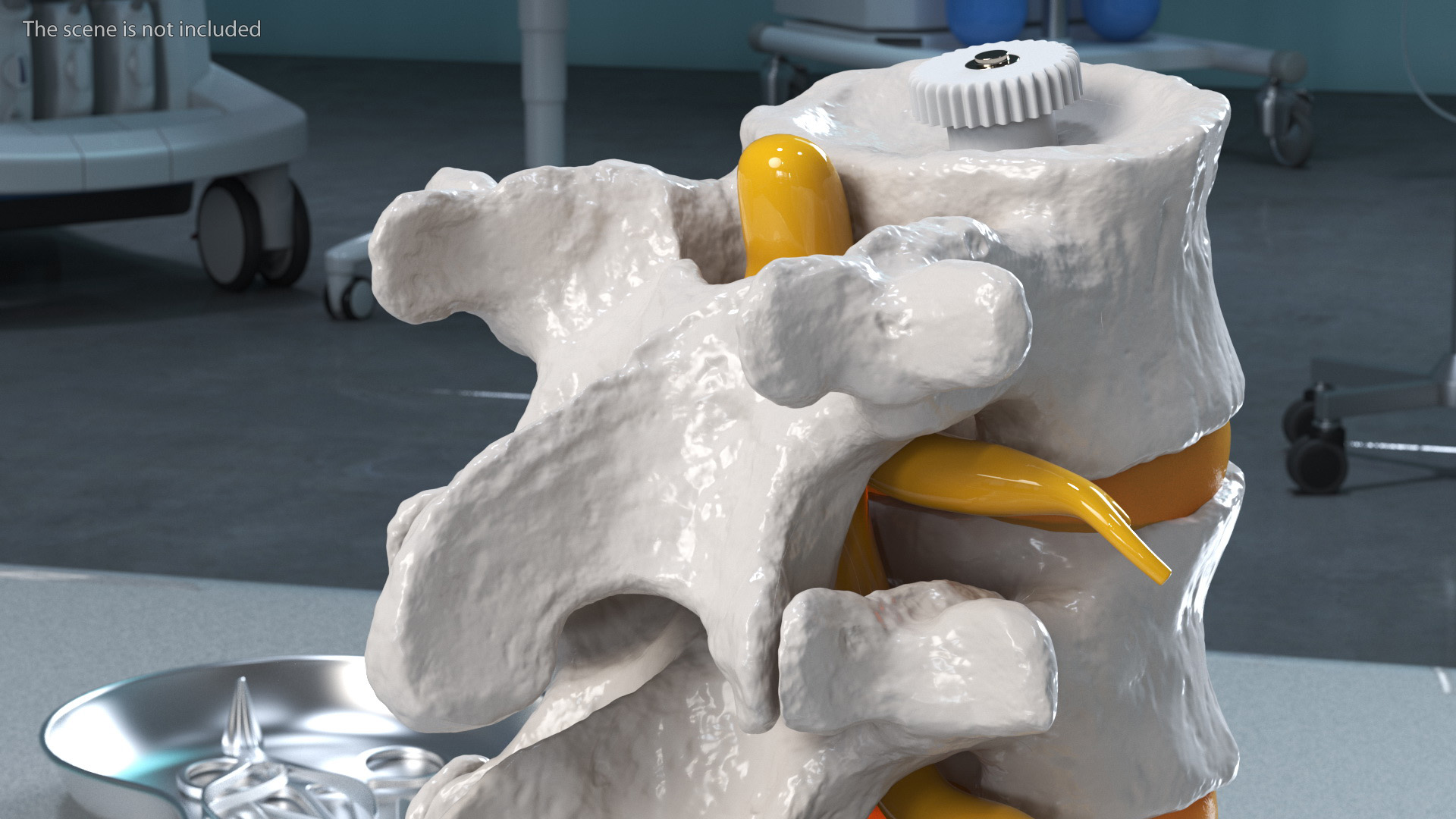3D Spinal Vertebrae with Hernia model
