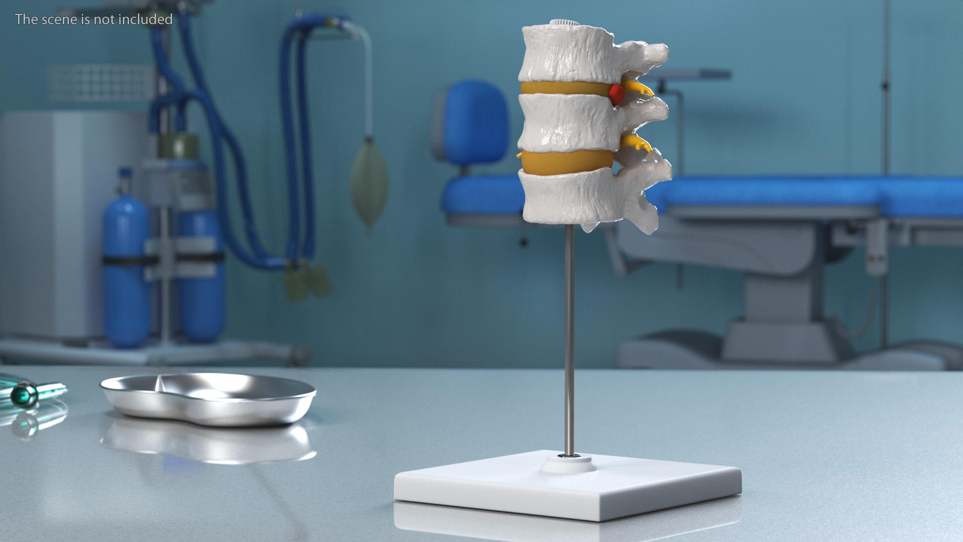3D Spinal Vertebrae with Hernia model