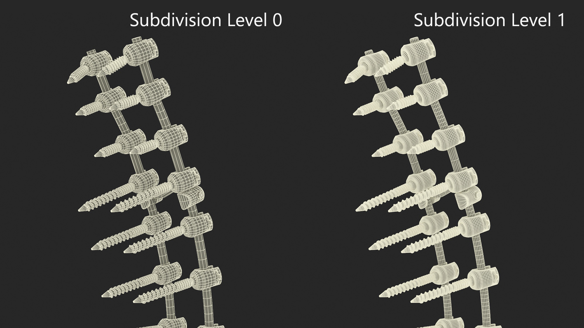 3D model Thoracic Spine Fixation System