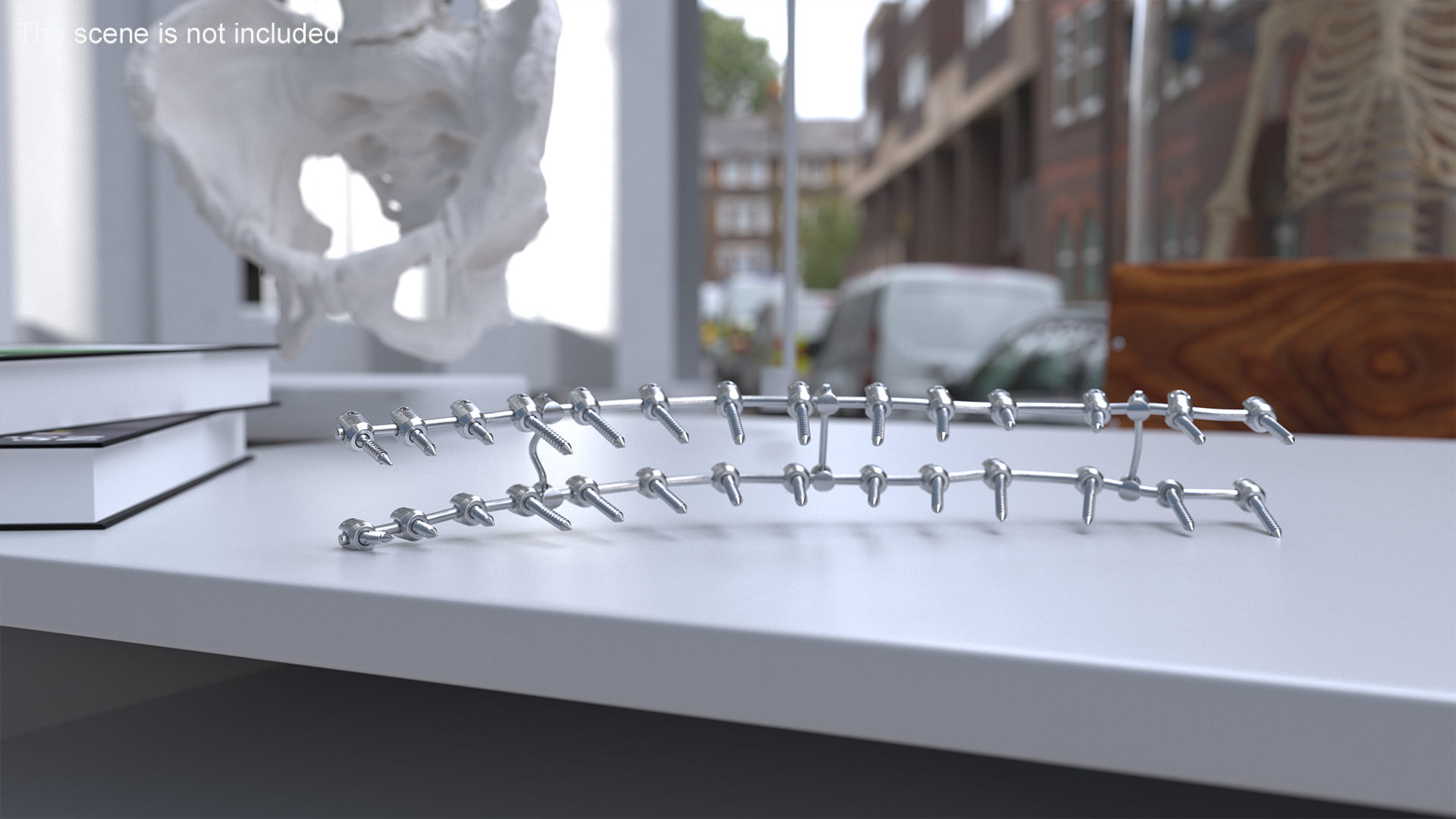 3D model Thoracic Spine Fixation System