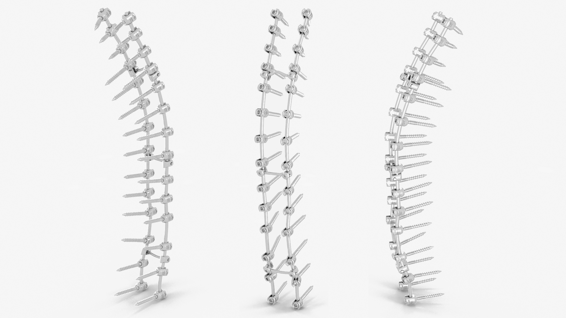3D model Thoracic Spine Fixation System