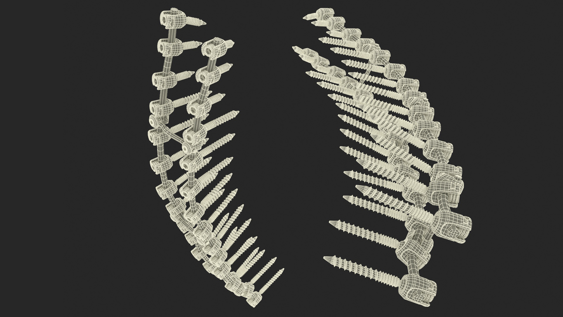 3D model Thoracic Spine Fixation System
