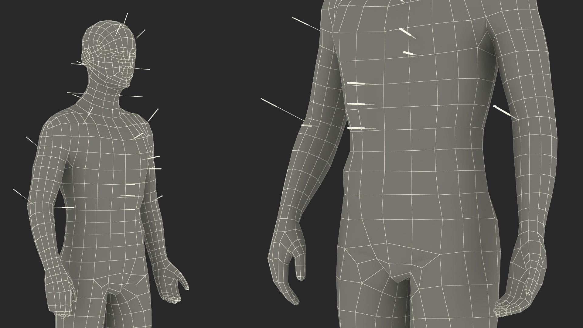 3D Male Acupuncture Anatomy Chart with Needles model