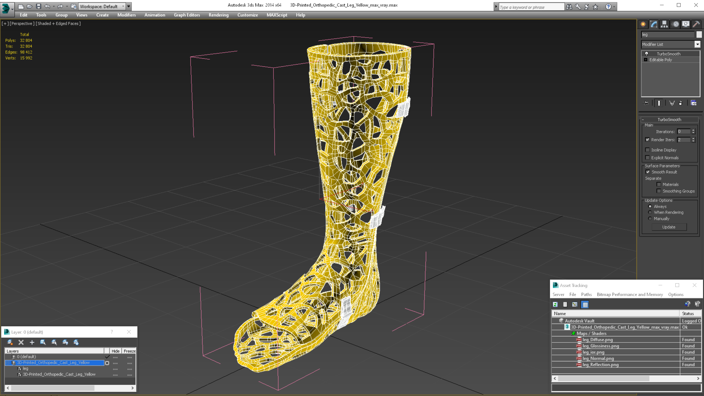 3D-Printed Orthopedic Cast Leg Yellow 3D