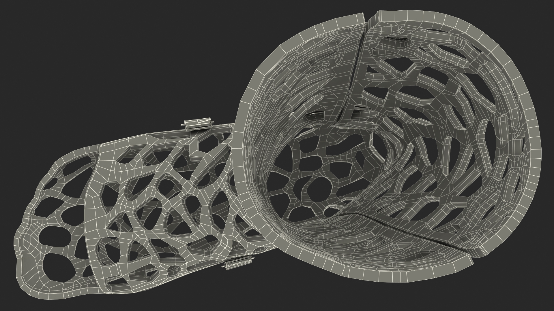 3D-Printed Orthopedic Cast Leg Yellow 3D