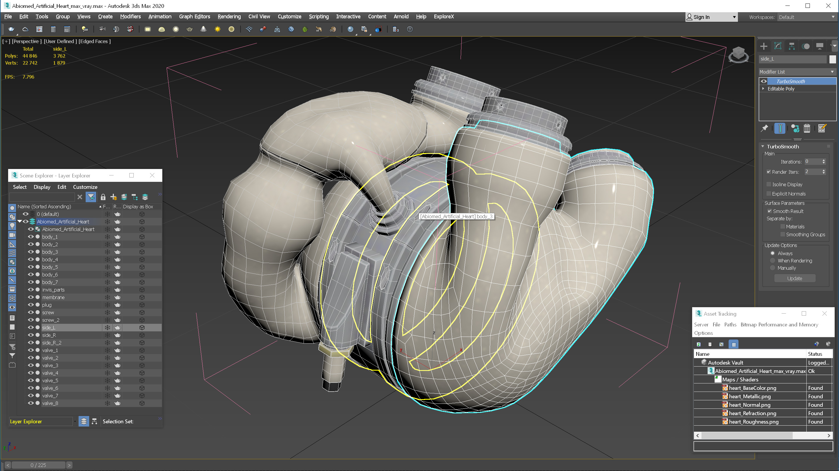 Abiomed Artificial Heart 3D model