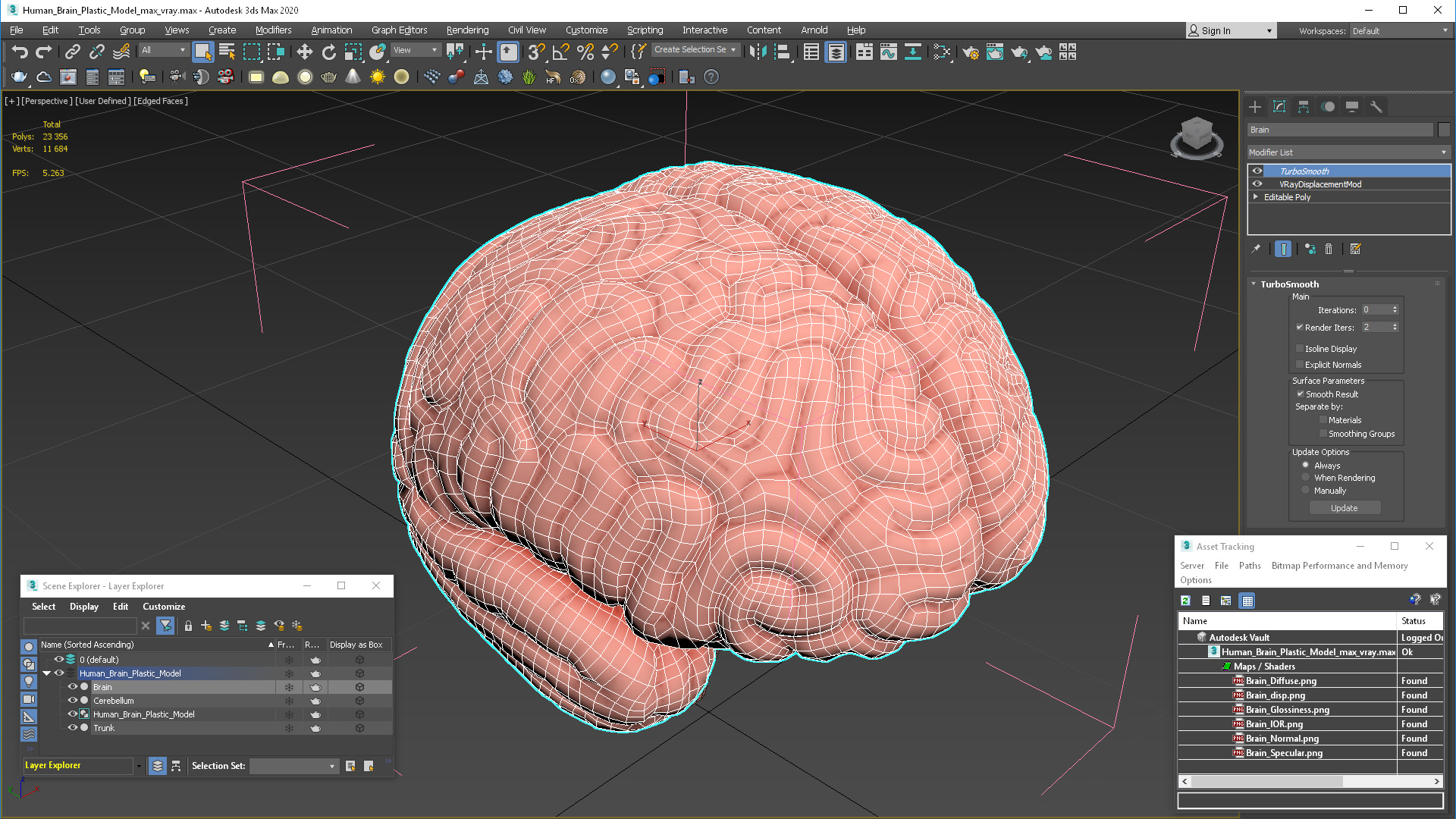 3D Human Brain Plastic Model for 3D Print model