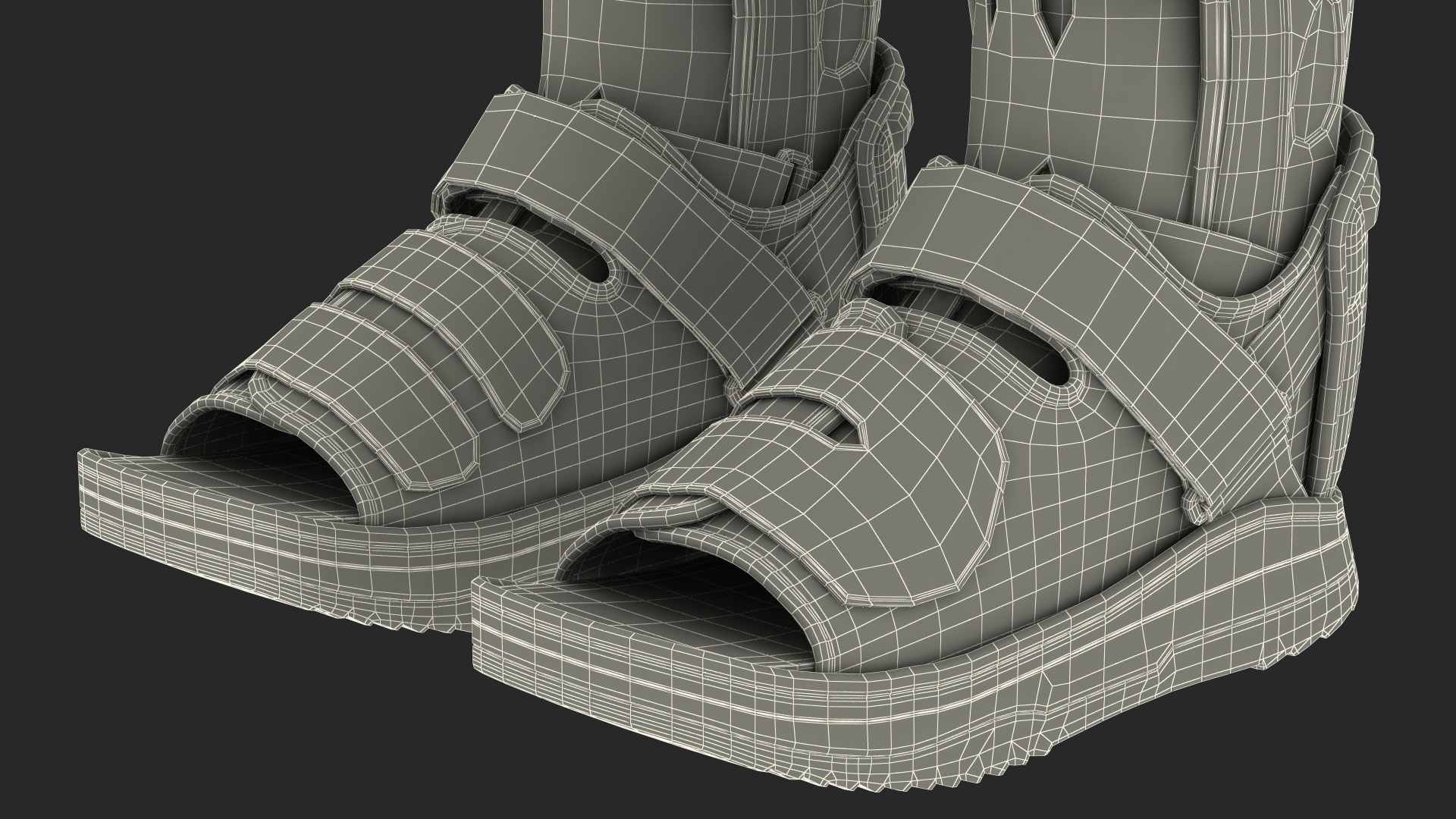3D Feet Orthotics Darco with Off-Loading Shoes for 3D Print