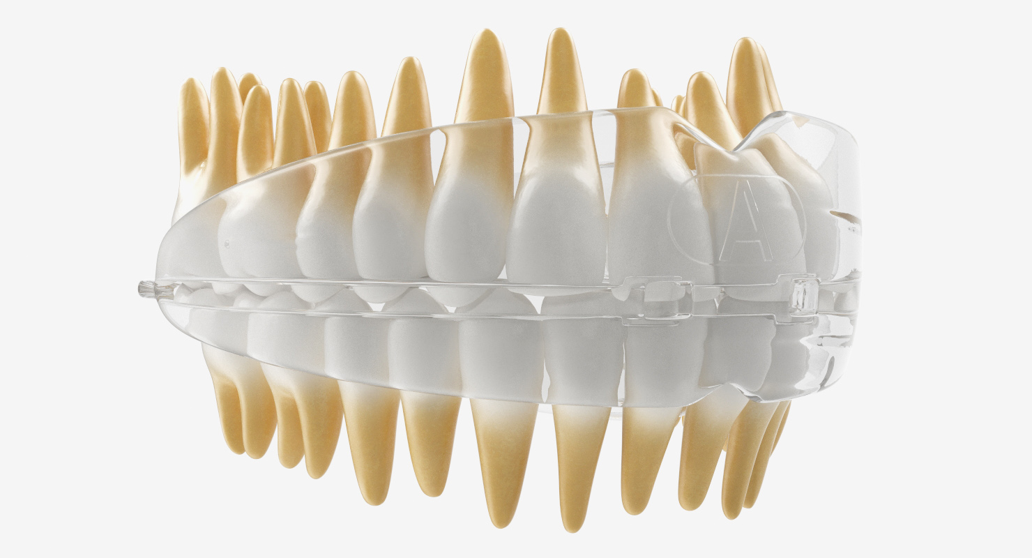 3D Dental Orthodontic Tooth Retainer model