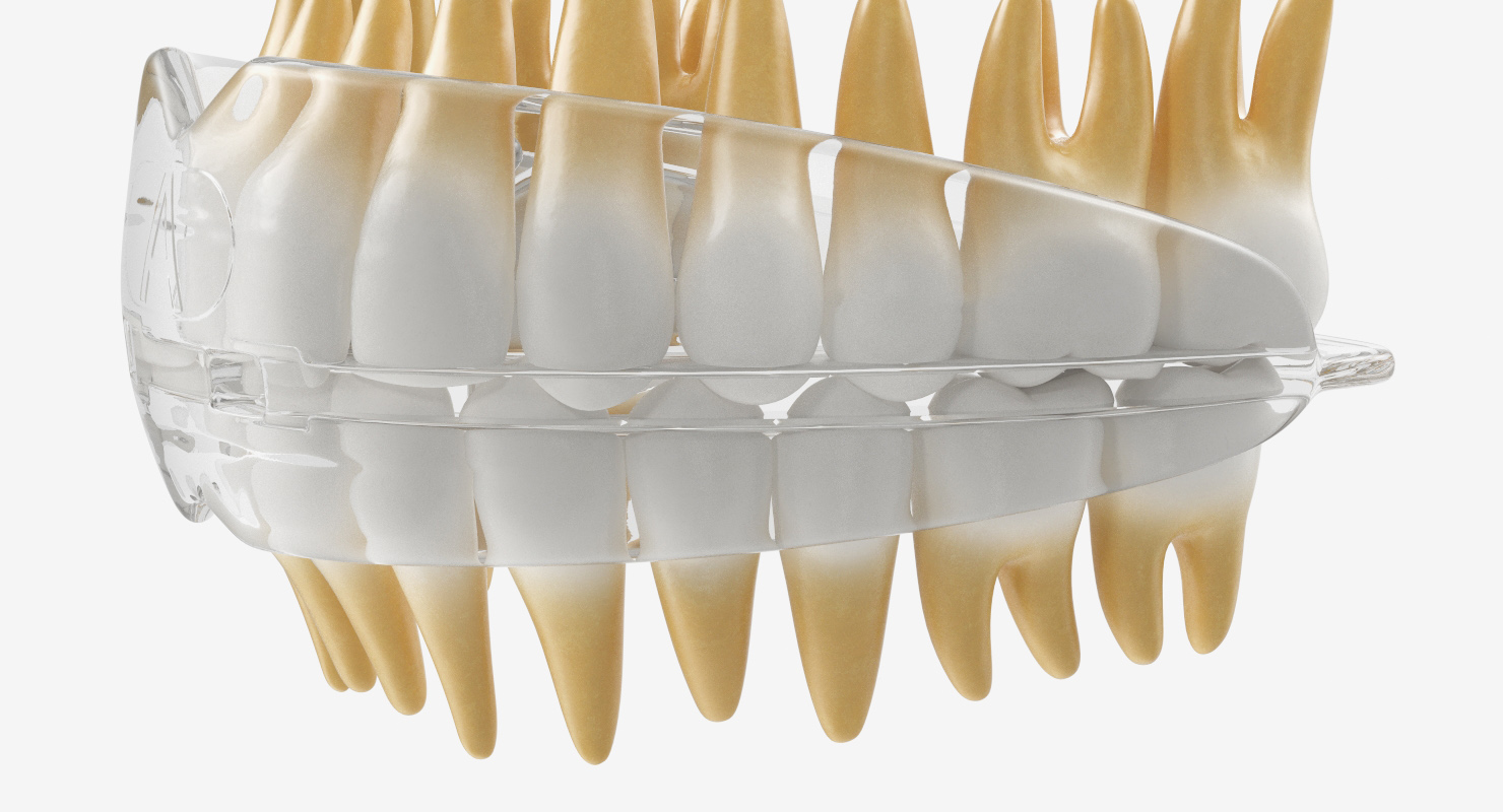 3D Dental Orthodontic Tooth Retainer model