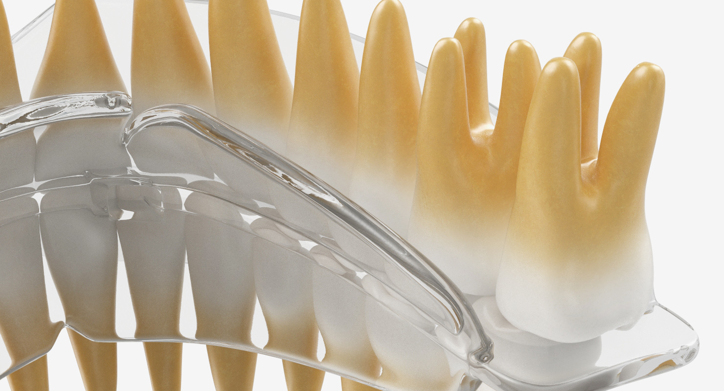 3D Dental Orthodontic Tooth Retainer model