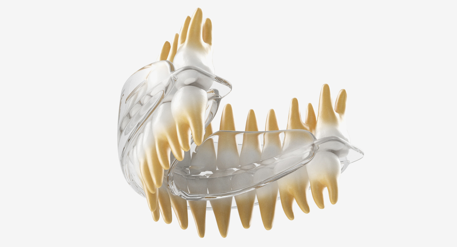 3D Dental Orthodontic Tooth Retainer model