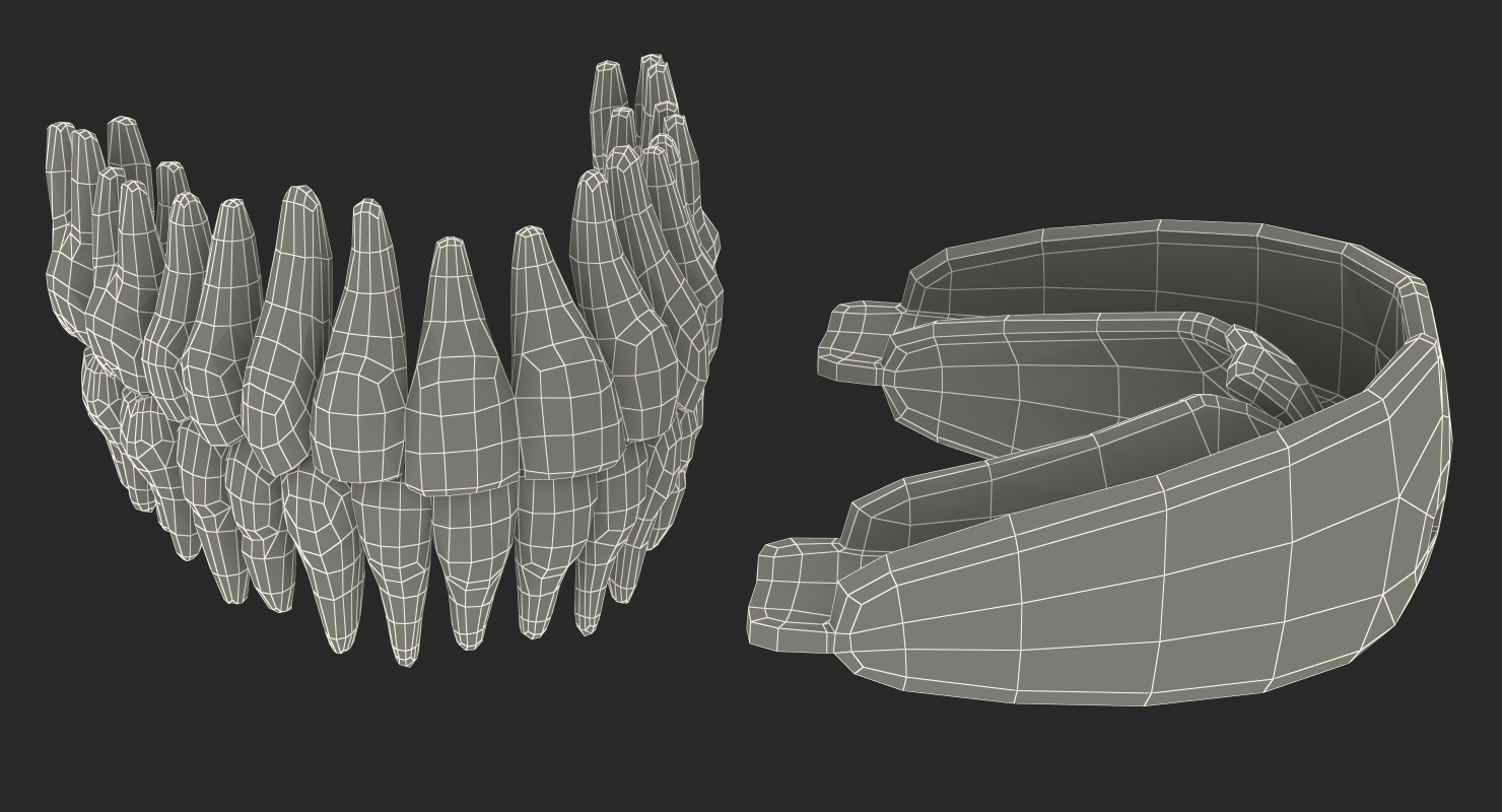 3D Dental Orthodontic Tooth Retainer model