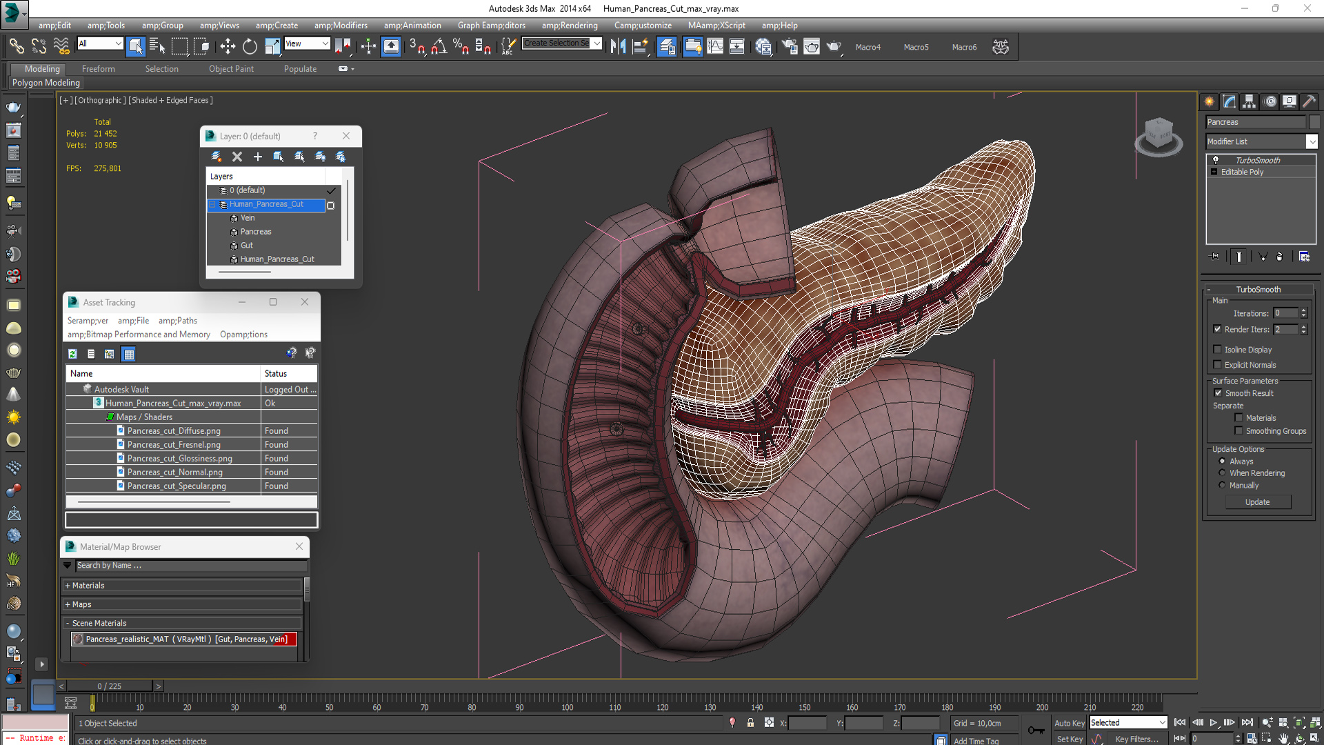 3D Human Pancreas Cut model