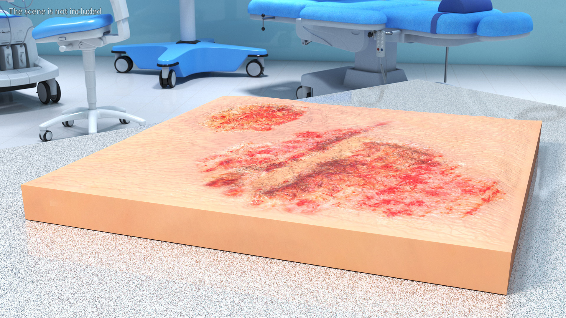 3D Grazed Skin